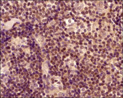 ROR gamma Antibody in Immunohistochemistry (Paraffin) (IHC (P))