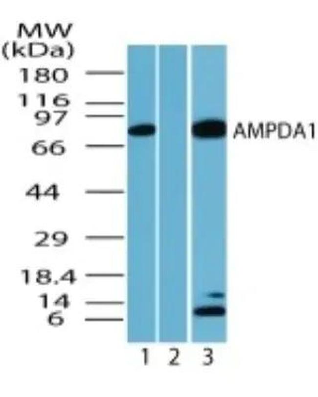 AMPD1 Antibody in Western Blot (WB)