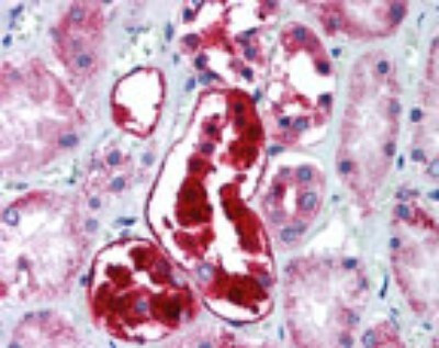 ATG5 Antibody in Immunohistochemistry (Paraffin) (IHC (P))