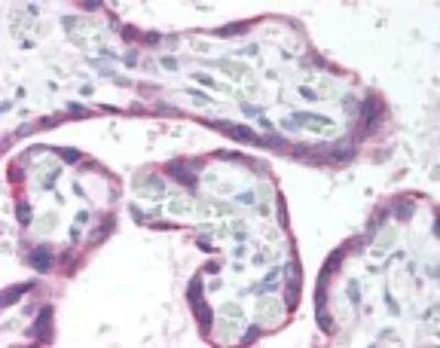 GRK5 Antibody in Immunohistochemistry (Paraffin) (IHC (P))