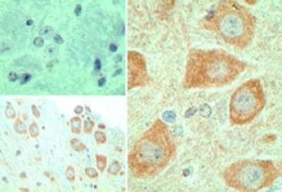 EBI3 Antibody in Immunohistochemistry (Paraffin) (IHC (P))