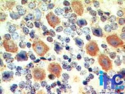 EBI3 Antibody in Immunohistochemistry (Paraffin) (IHC (P))