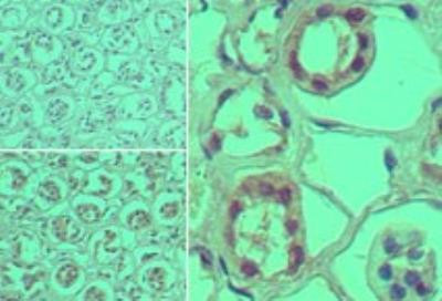 ST2 Antibody in Immunohistochemistry (Paraffin) (IHC (P))