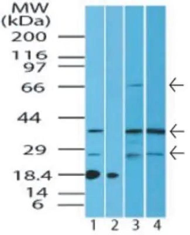 ST2 Antibody in Western Blot (WB)