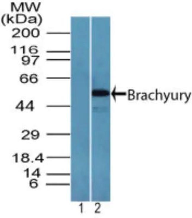 Brachyury Antibody in Western Blot (WB)