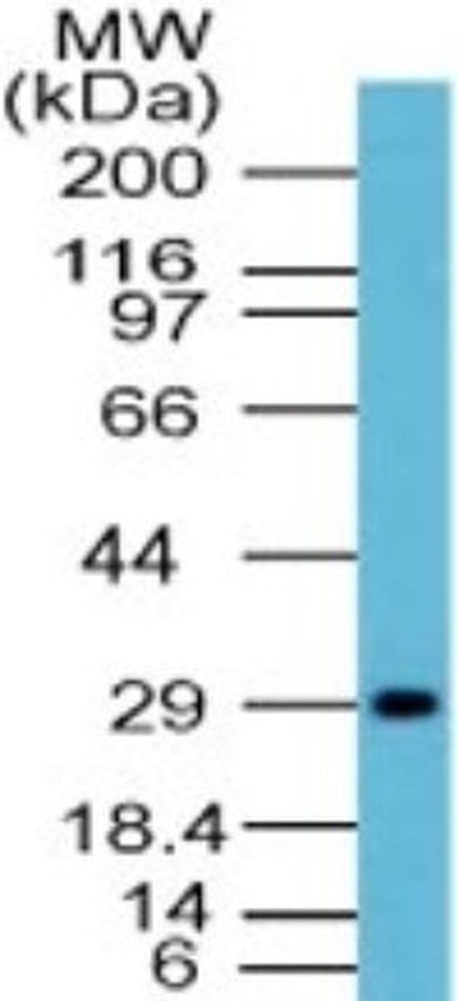 Influenza A H1N1 NA Antibody in Western Blot (WB)