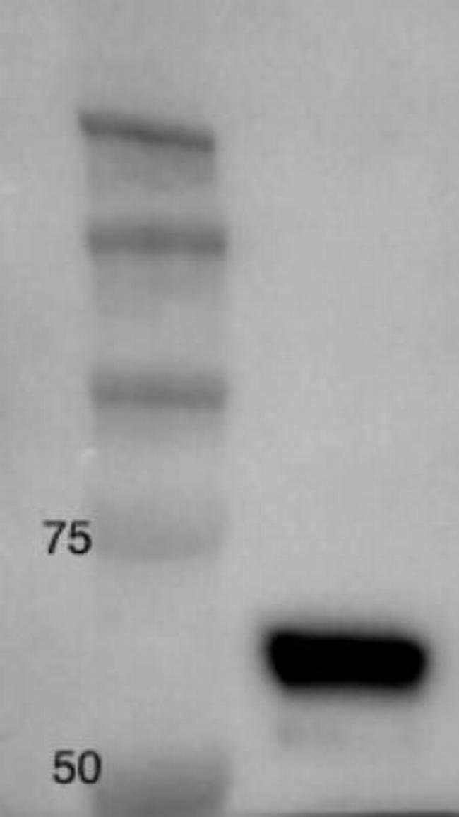 hnRNP K Antibody in Western Blot (WB)