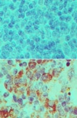 Importin 7 Antibody in Immunohistochemistry (Paraffin) (IHC (P))