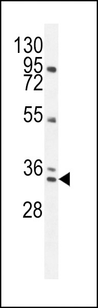 AKIP1 Antibody in Western Blot (WB)