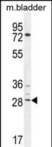 AKIP1 Antibody in Western Blot (WB)