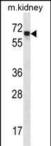 Angiopoietin 2 Antibody in Western Blot (WB)