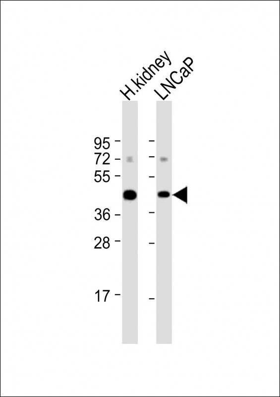 AMACR Antibody in Western Blot (WB)