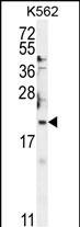 BTG2 Antibody in Western Blot (WB)