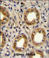 CXCR3 Antibody in Immunohistochemistry (Paraffin) (IHC (P))