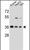 FBXO2 Antibody in Western Blot (WB)