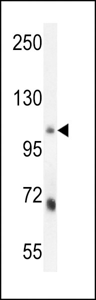 MLXIP Antibody in Western Blot (WB)