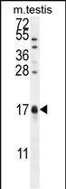 CAMK2N1 Antibody in Western Blot (WB)