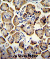 RADIL Antibody in Immunohistochemistry (Paraffin) (IHC (P))