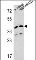 L2HGDH Antibody in Western Blot (WB)