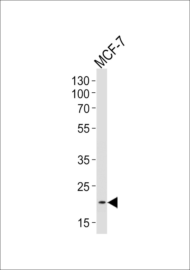 NOS1AP Antibody in Western Blot (WB)