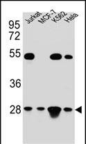 TFAM Antibody in Western Blot (WB)