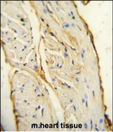 IBA1 Antibody in Immunohistochemistry (Paraffin) (IHC (P))