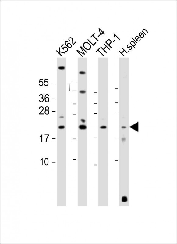 IBA1 Antibody in Western Blot (WB)