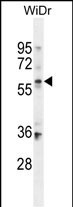 BCMO1 Antibody in Western Blot (WB)