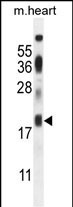 ISCA2 Antibody in Western Blot (WB)