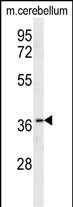 Olfr417 Antibody in Western Blot (WB)