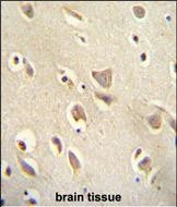 MCHR1 Antibody in Immunohistochemistry (Paraffin) (IHC (P))