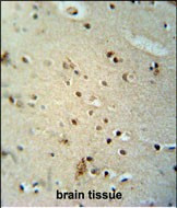 CIC Antibody in Immunohistochemistry (Paraffin) (IHC (P))