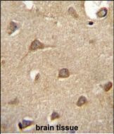 ENTPD3 Antibody in Immunohistochemistry (Paraffin) (IHC (P))