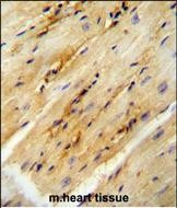 GPD1L Antibody in Immunohistochemistry (Paraffin) (IHC (P))