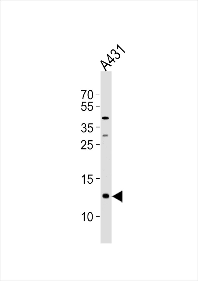 SPRR2A Antibody in Western Blot (WB)