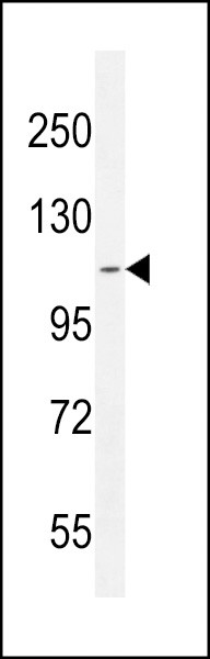 ATP8B2 Antibody in Western Blot (WB)