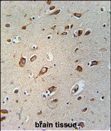 WDPCP Antibody in Immunohistochemistry (Paraffin) (IHC (P))