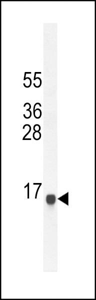 SPAG11A Antibody in Western Blot (WB)