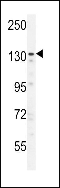 ZNF536 Antibody in Western Blot (WB)