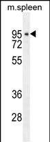 DTL Antibody in Western Blot (WB)