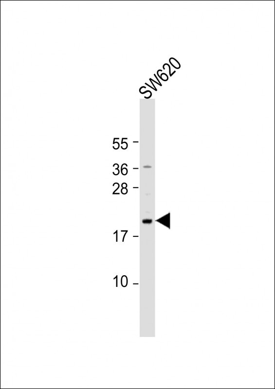 NUDT15 Antibody in Western Blot (WB)