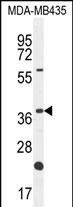 OR6V1 Antibody in Western Blot (WB)