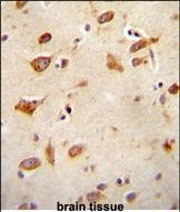 GFRAL Antibody in Immunohistochemistry (Paraffin) (IHC (P))