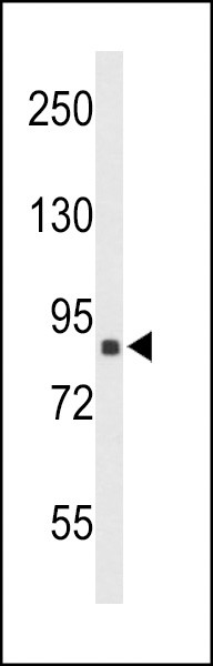 TNPO1 Antibody in Western Blot (WB)