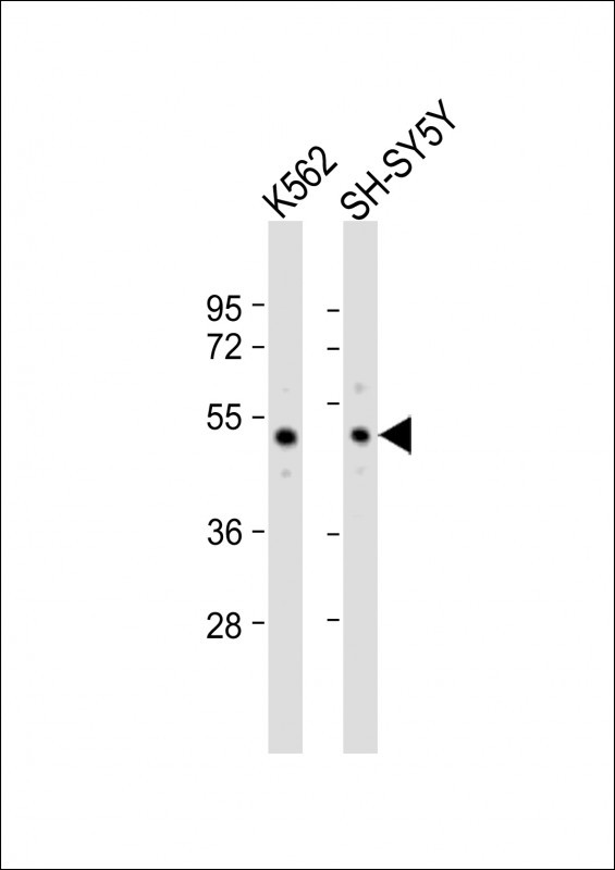 SMPD2 Antibody in Western Blot (WB)
