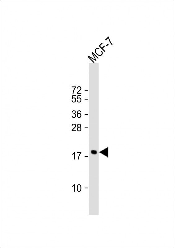 Cofilin Antibody in Western Blot (WB)