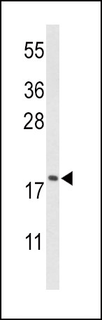 Cofilin Antibody in Western Blot (WB)