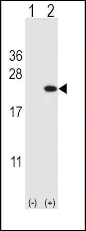 Cofilin Antibody in Western Blot (WB)