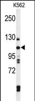 TELO2 Antibody in Western Blot (WB)