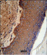 KRT9 Antibody in Immunohistochemistry (Paraffin) (IHC (P))